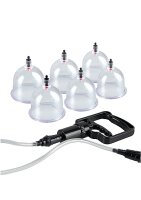 Beginners Cupping Set - 6pcs